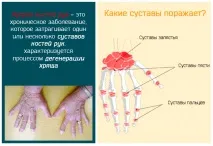 симптоми