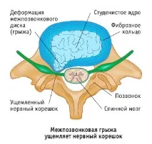 армията