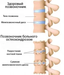 гръбначния