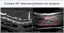 Хвороба міжхребцевих дисків у собак міжхребцевих