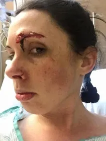 Дівчина, що вийшла на пробіжку, дала відсіч насильникові, що напав на неї, кращі історії з усього світу. дівчина