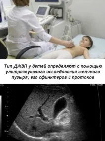 Дискінезії жовчовивідних шляхів (ДЖВП) шляхів