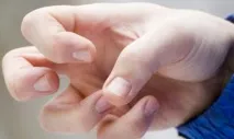 Епілептичний статус захворювання
