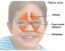Гайморові пазухи будова та лікування, Все про пародонтоз лікування