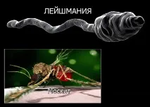 захворювання
