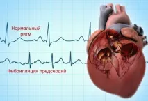 Ізоптін показання та інструкція із застосування, ціна, аналоги та відгуки застосування