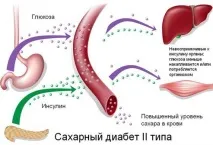 Таблетки від діабету 2 типу список – повний список препаратів таблетки