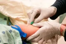 Онкомаркери кишечника опис, розшифровка, ціни - Здоров’я Інфо кишечника
