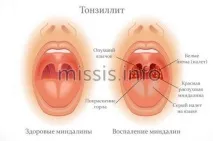 прекомерно