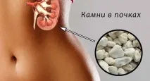 лікування