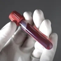 Підвищений гемоглобін у крові – про що попереджає організм організм
