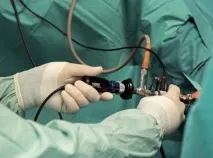 Видалення сечового міхура у чоловіків (цистектомія) цистектомія