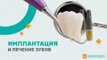Мережа стоматологій «Менделєєв» відео - Відео серфінг стоматологій