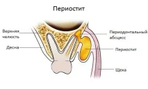 лікування