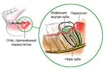 методи