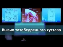 Трава оман застосування оман застосування трава