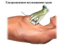 УЗД молочних залоз молочних
