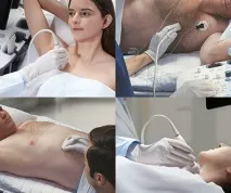 УЗД поверхневих груп лімфатичних вузлів - Заболотська Н поверхневих