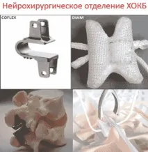 Встановлення міжостистих протезів Aperius, DIAM у Львові встановлення