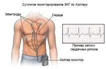 представлява