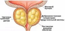являє