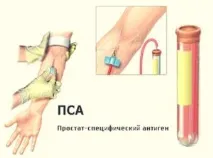 являє