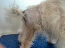 алопеція
