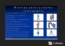 Артроз у бодібілдингу розвитку