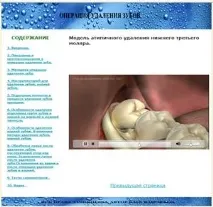 TurboSite. Створюємо проект, задаємо параметри ЕУІ. параметри