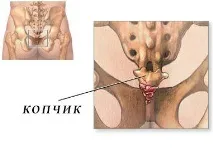 коцигодиния