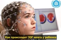 ЕЕГ головного мозку дитині дитині