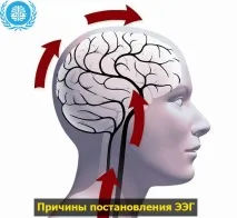 ЕЕГ головного мозку дитині головного