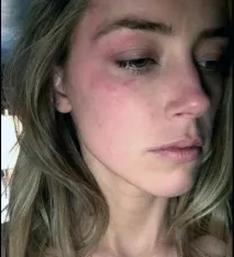 До весілля з Джонні Деппом Ембер Херд жила у шлюбі з жінкою, Журнал Cosmopolitan джонні
