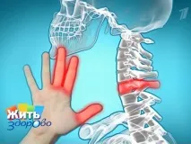 Олена Малишева Остеохондроз іде миттєво! Вражаюче відкриття в лікуванні остеохондрозу малишева