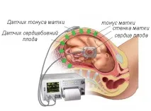 Ехокардіографія плоду коли виконувати ЕхоКГ, що показує, як проводиться і види дослідження коли