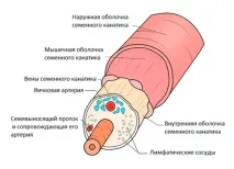 Водянка яєчка після варикоцеле може розвиватися в період від одного місяця до 2 років може