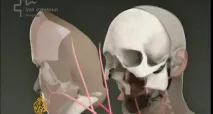 Як написати текст на медичну тематику (детальний кейс) текст