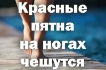 Червоні плями на ногах ступнях, з’явилися, сверблять червоні