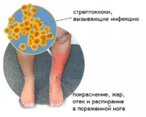 Червоні плями на ногах ступнях, з’явилися, сверблять плями