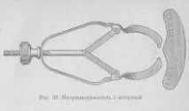 Методика пломбування амальгамою, Терапевтична стоматологія. терапевтична