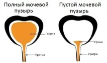 Обсяг сечового міхура у чоловіків розмір, норма місткості сечового міхура людини - Живи Здорово сечового