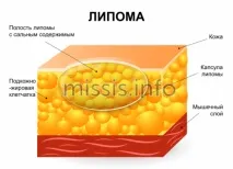 залози