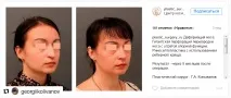 Основи просування клініки в instagram інстаграмі