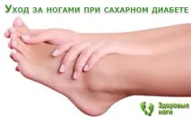 Пам’ятка правила догляду за ногами при цукровому діабеті правила
