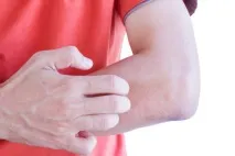 Пляжні блохи та мухи у В’єтнамі або що кусається на пляжах Фукуока, Ще один чудовий крок мухи