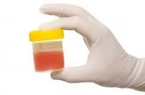 Показання для проведення екскреторної урографії нирок екскреторної