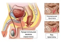 профилактика