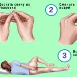 Свічки від геморою Нігепан інструкція із застосування, рекомендації, відгуки, ціни геморою