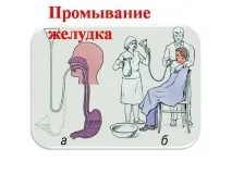 Нудить з похмілля що робити і як позбутися нудоти після пиятики нудить