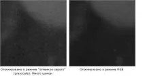 Відновлюємо старі фотографії відновлюємо